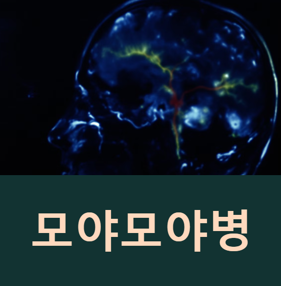 모야모야병 유전 뜻 증상 원인 뇌출혈 수술 치료 진단방법 알아보기