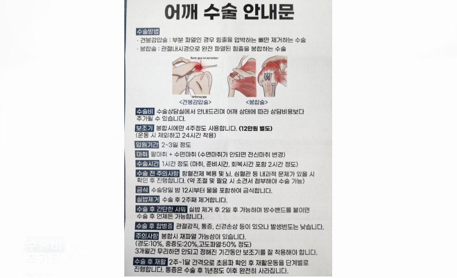 어깨 수술 안내문