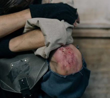 축농증 원인 증상 예방법