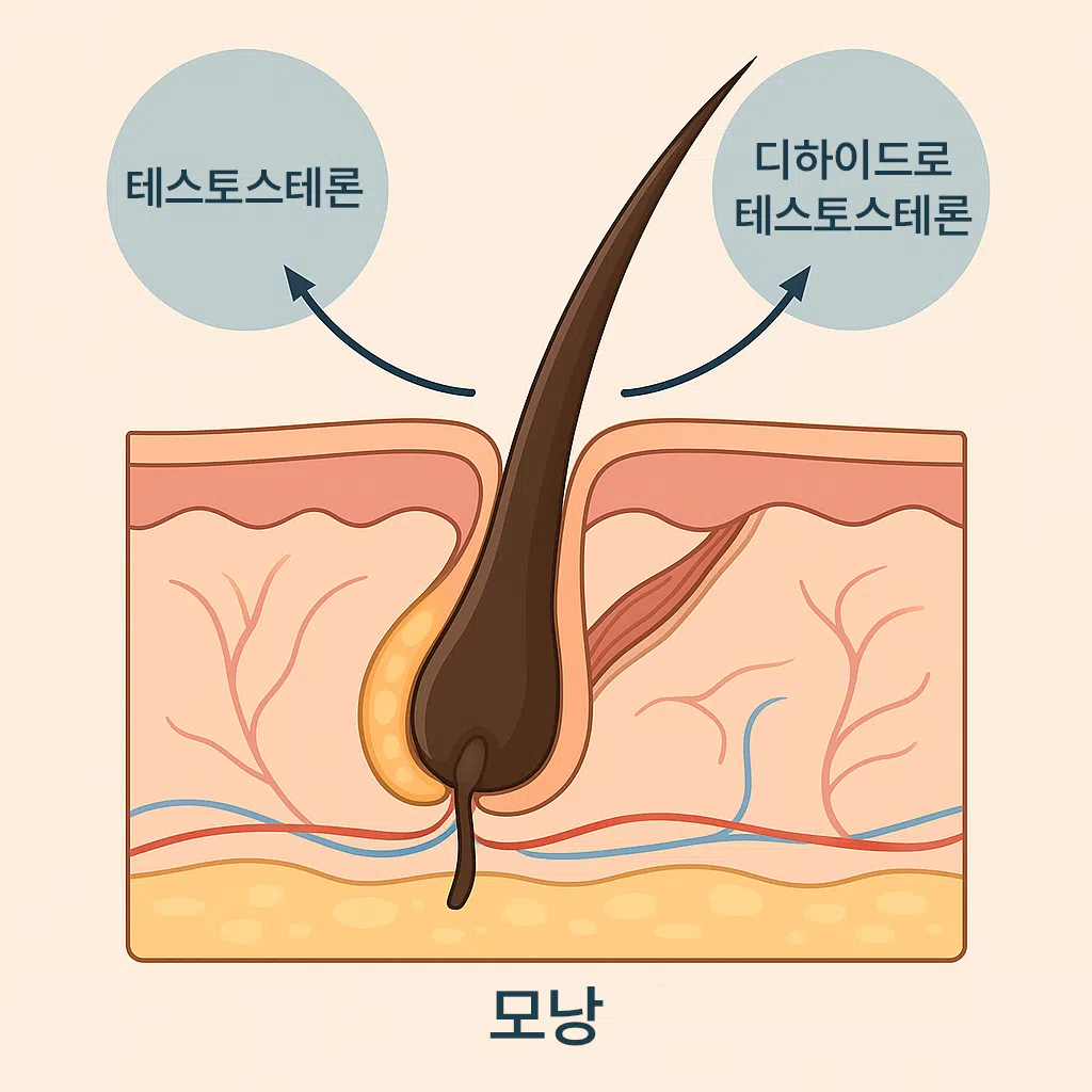 모낭 단면과 테스토스테론‧DHT 상호작용