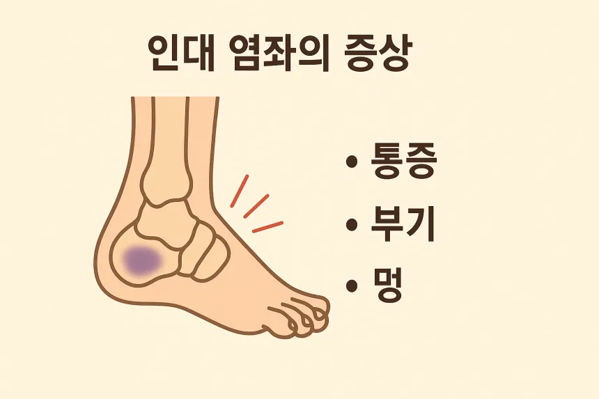 인대가 늘어났을 때 증상