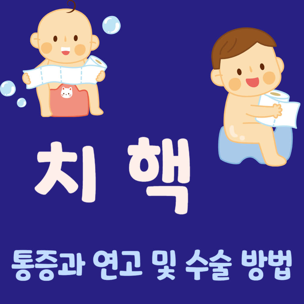 치핵 통증과 연고 및 수술 방법