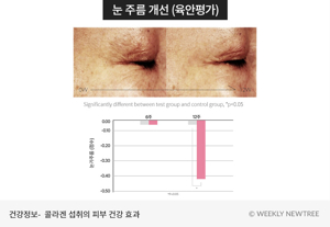 피부콜라겐
