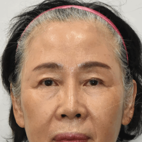 이마거상후기