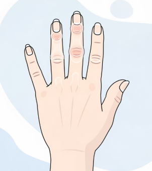 손가락 마디 통증