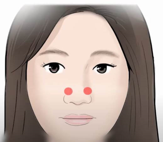 상영향혈 위치