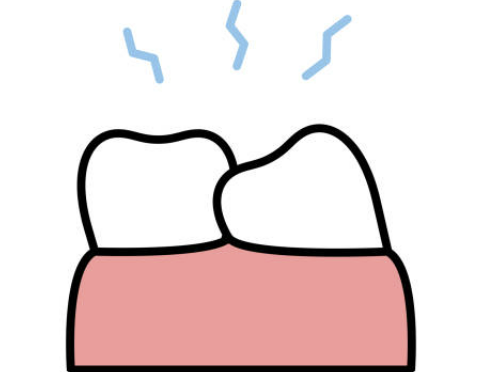 사랑니 발치후 식사 주의사항 가이드