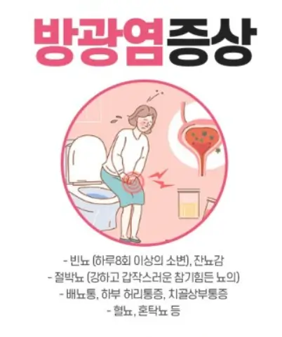 방광염 증상