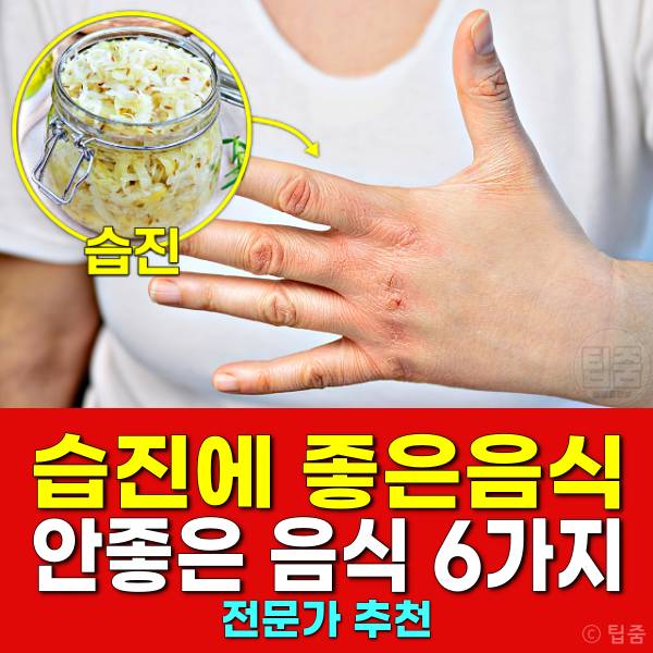 습진에 좋은음식 안좋은음식