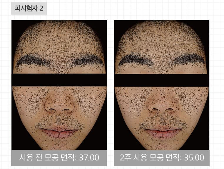 메디큐브 제로모공패드 2.0 효과 및 가격 (유재석 패드)