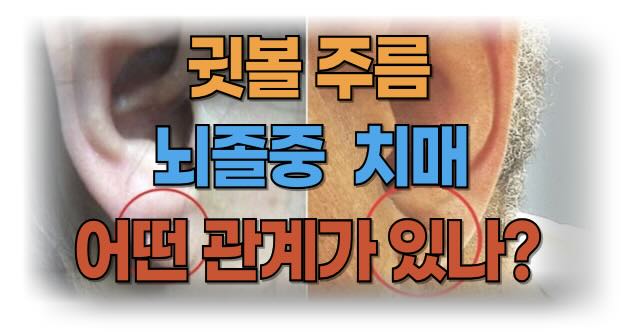 뇌졸중 전조증상 귓볼주름 귀주름