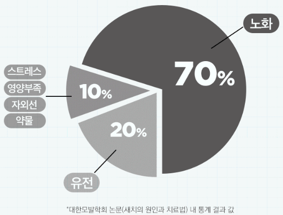새치 원인 조사 결과