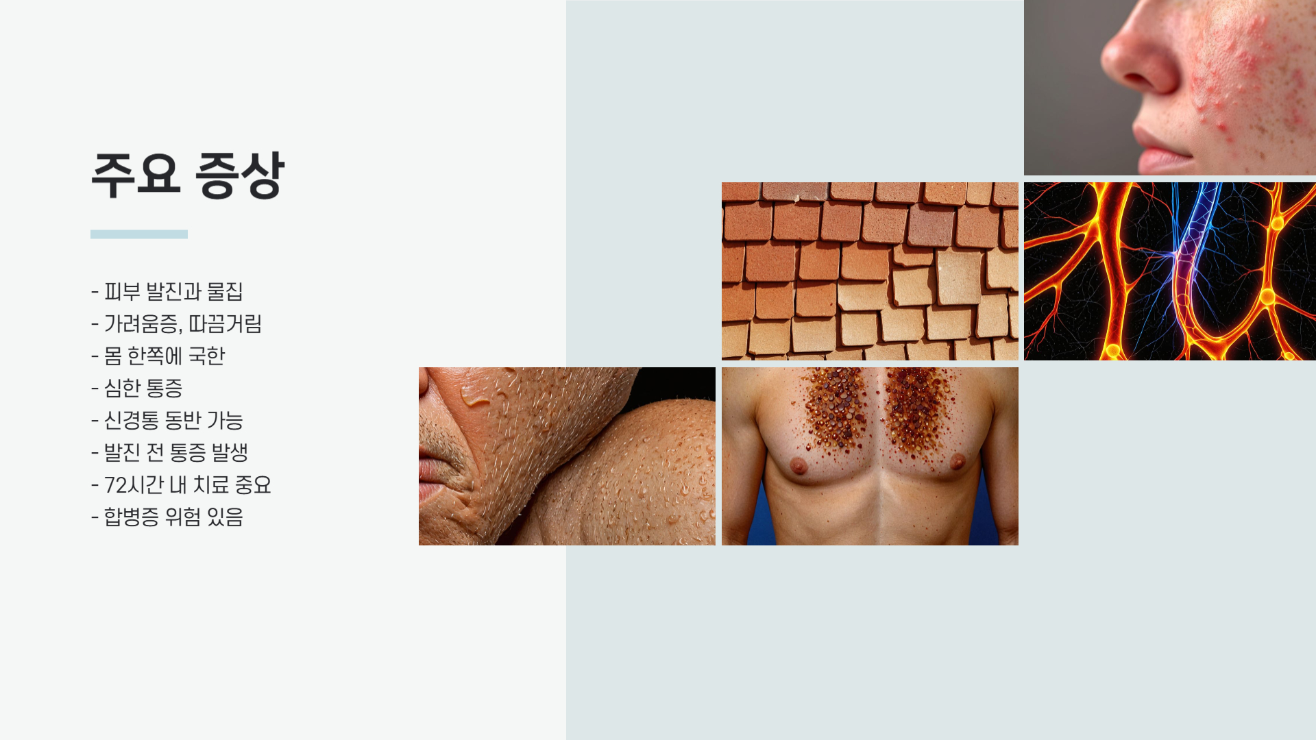 대상포진 증상과 전염성 꼭 알아야 할 정보