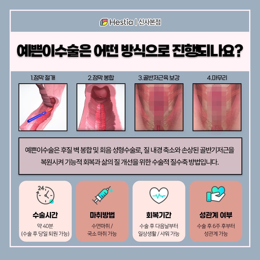 질수축수술은 어떻게 진행될까요?