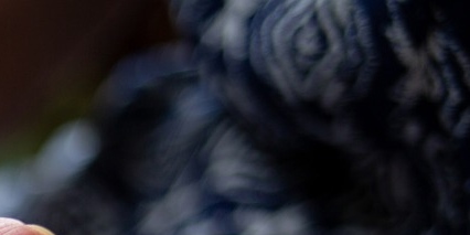 류마티스관절염