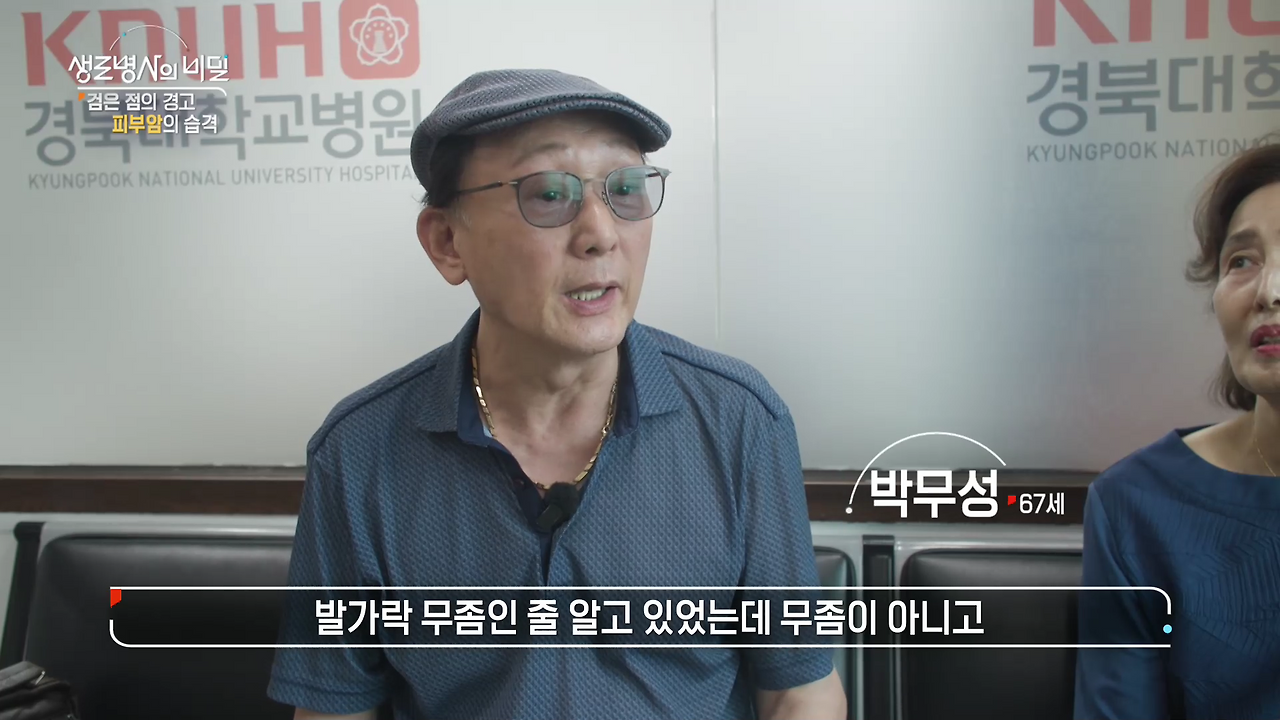 생로병사의 비밀 피부암 검은점