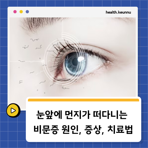 비문증