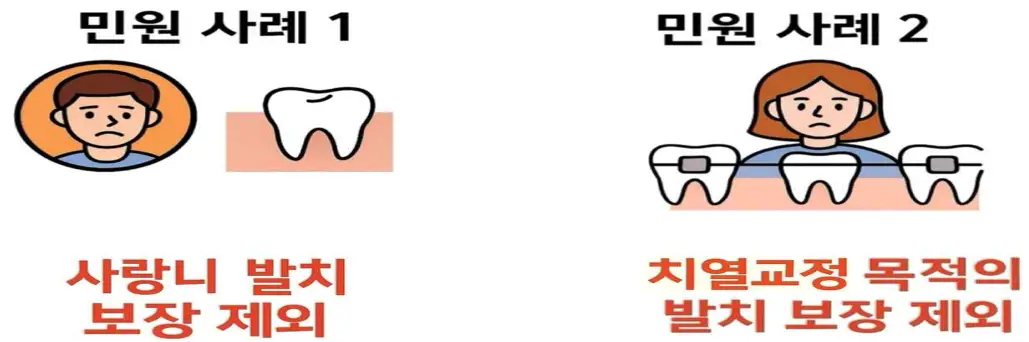 사랑니나 교정목적의 치아 발치 사례