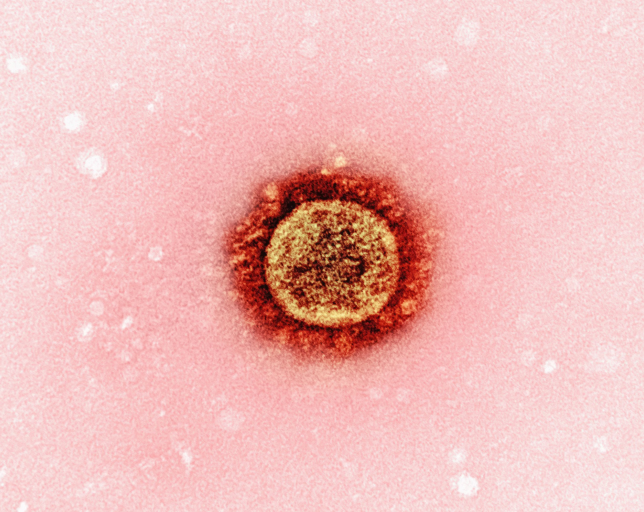 헬리코박터 전염