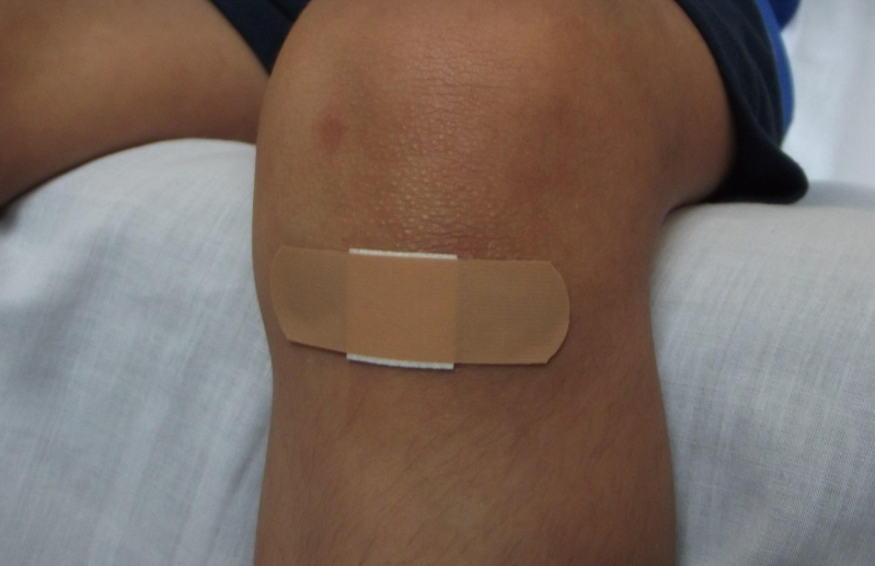 아이 무릎 반창고 사진