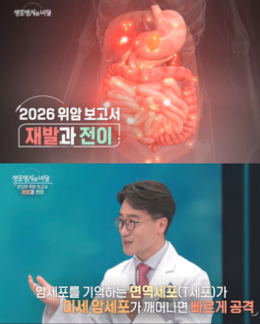 -2026-위암보고서