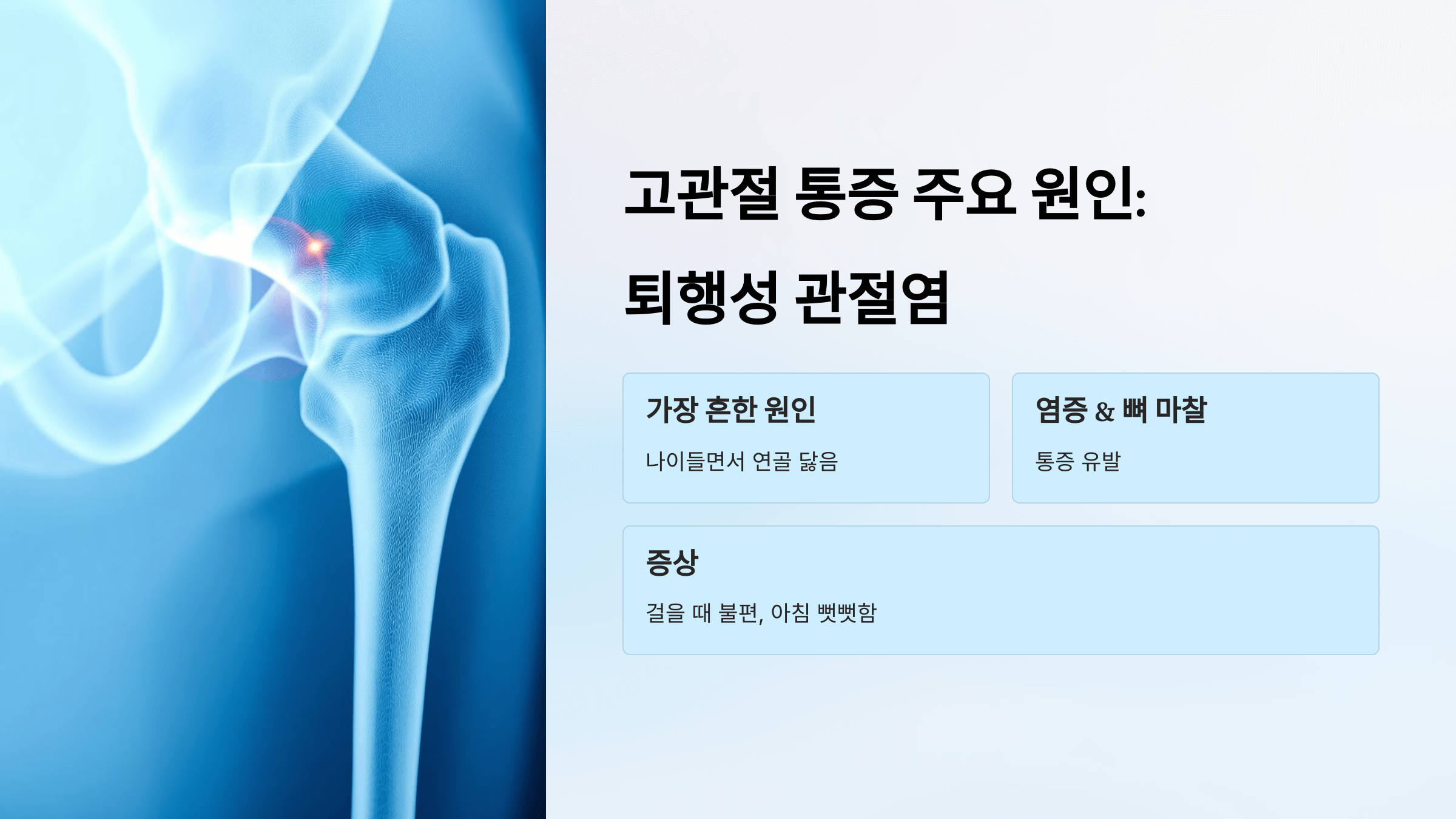 고관절 사진입니다.