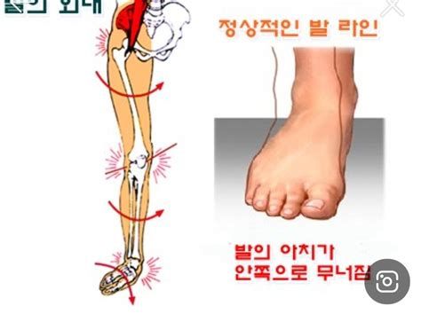 허리가 아픈 이유