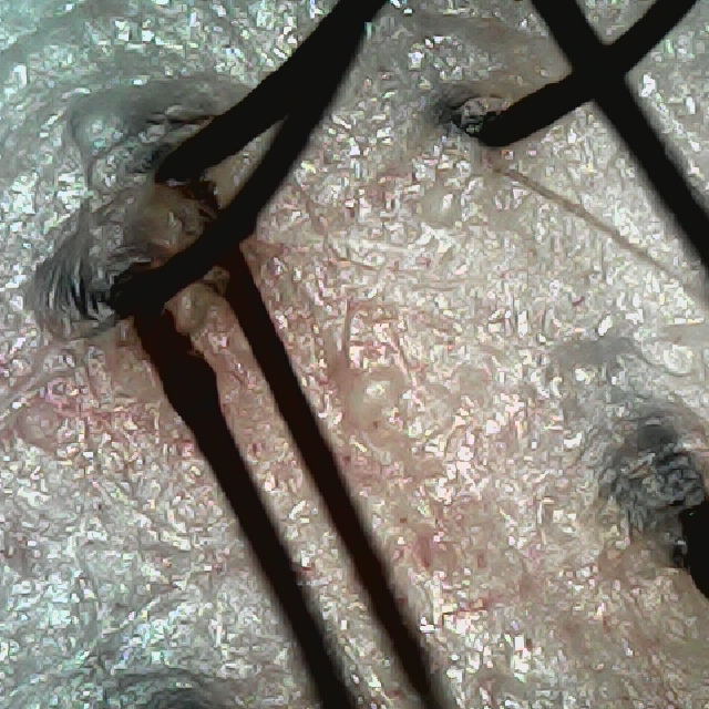 탈모 극복 프로젝트 - 뒷머리 두피 모습이다.