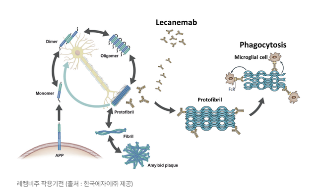 젊은 알츠하이머병과 그로 인한 고통 관련 이미지