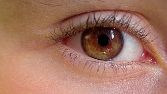 눈 실핏줄 터짐&amp;#44; 단순 피로일까?