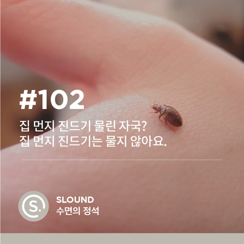 진드기 물린자국 대처법 참진드기 빨간 진드기 증상 확인_5