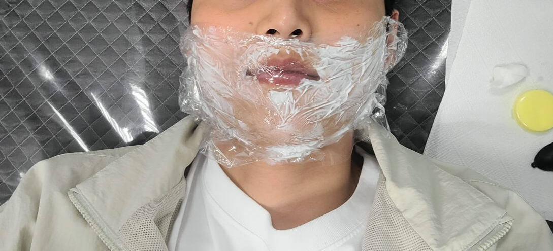 진짜 레이저 시술 기다리는 중