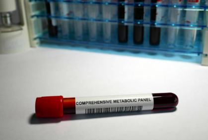 유효성분 및 대사체 동시 분석 전략 &ndash; LC-MS/MS 기반 복합 분석법 개발