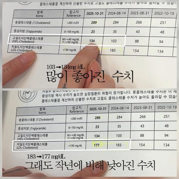 HDL과 LDL 비교사진