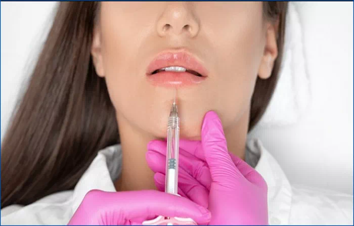 입술필러 주사