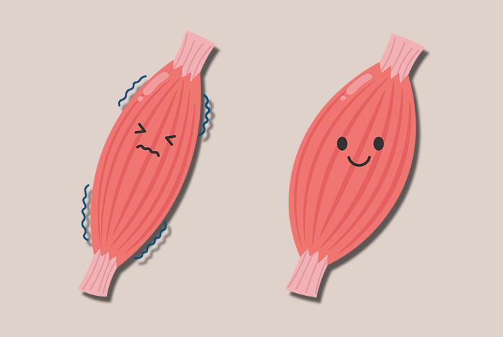 근육경련이-일어난-근육-모습