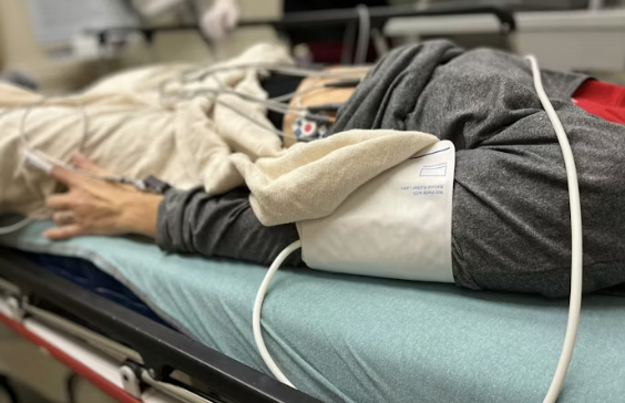 근막구획증후군 신속 치료 골든타임