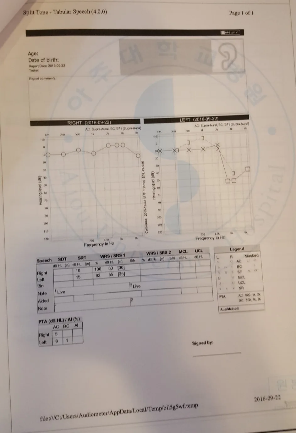 9월 22일 아주대병원 청력검사 결과지