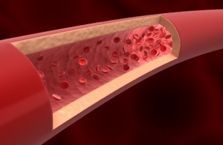 심혈관질환 관리와 예방