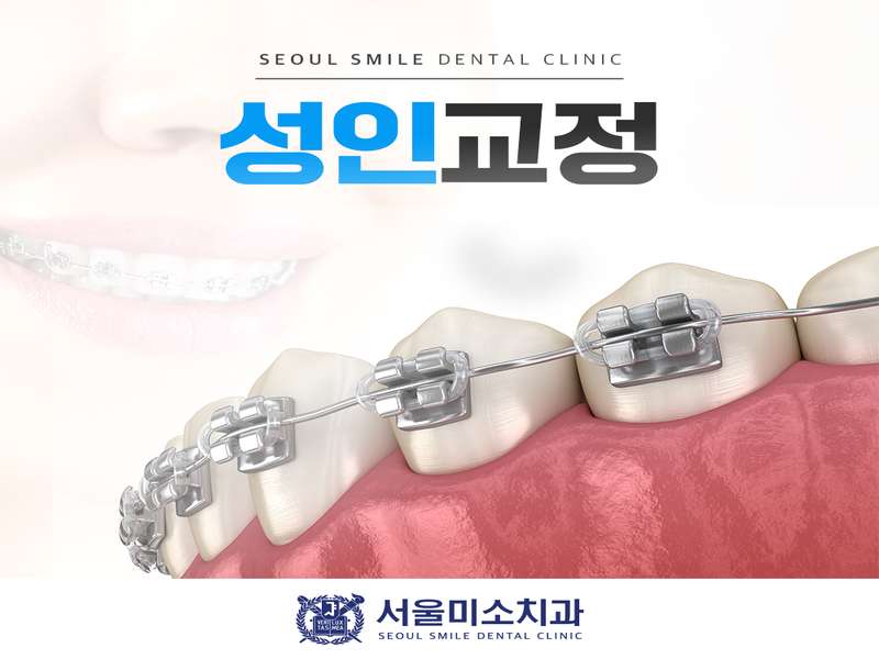 울산 동구 임플란트 치과 BEST4 | 가격비교 | 추천 | 후기 | 저렴한곳 | 전문 병원 | 총정리 - 2. 서울미소치과의원 소개 - 2.2 환자 만족도 2.2 환자 만족도