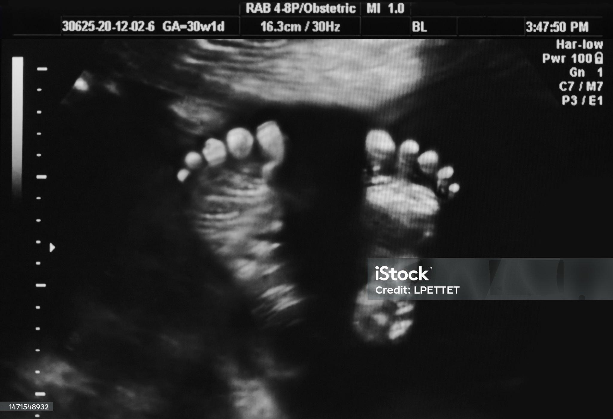 초음파 영상이란?