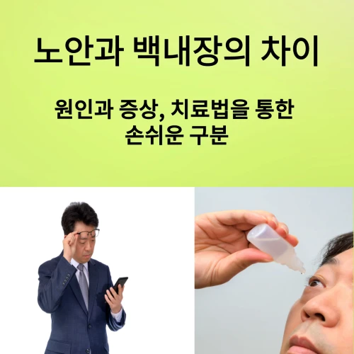 노안과 백내장의 차이