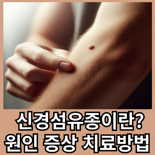 신경섬유종 증상 피부섬유종 치료 방법