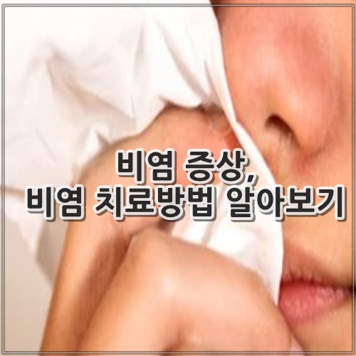 비염 증상, 비염 치료방법 알아보기