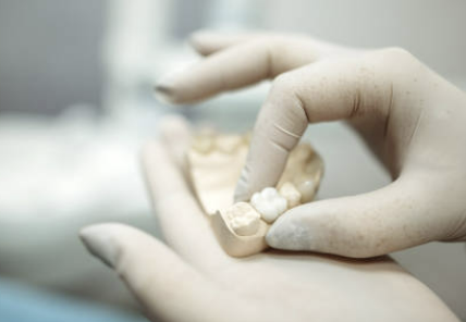 임플란트 가격 확인 최저가 확인 시술기간 (최신)