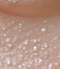 눈밑에 하얀 좁쌀