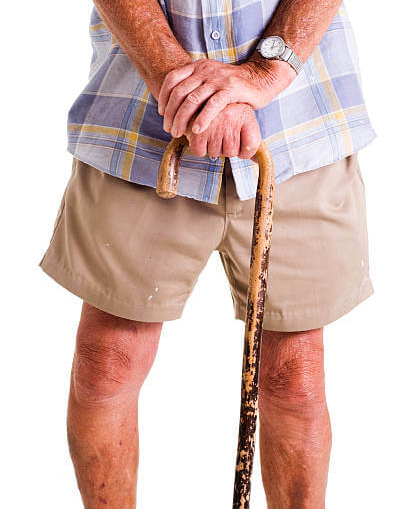 “나이가 들수록 왜 다리 모양이 O자형으로 변형되나요?”