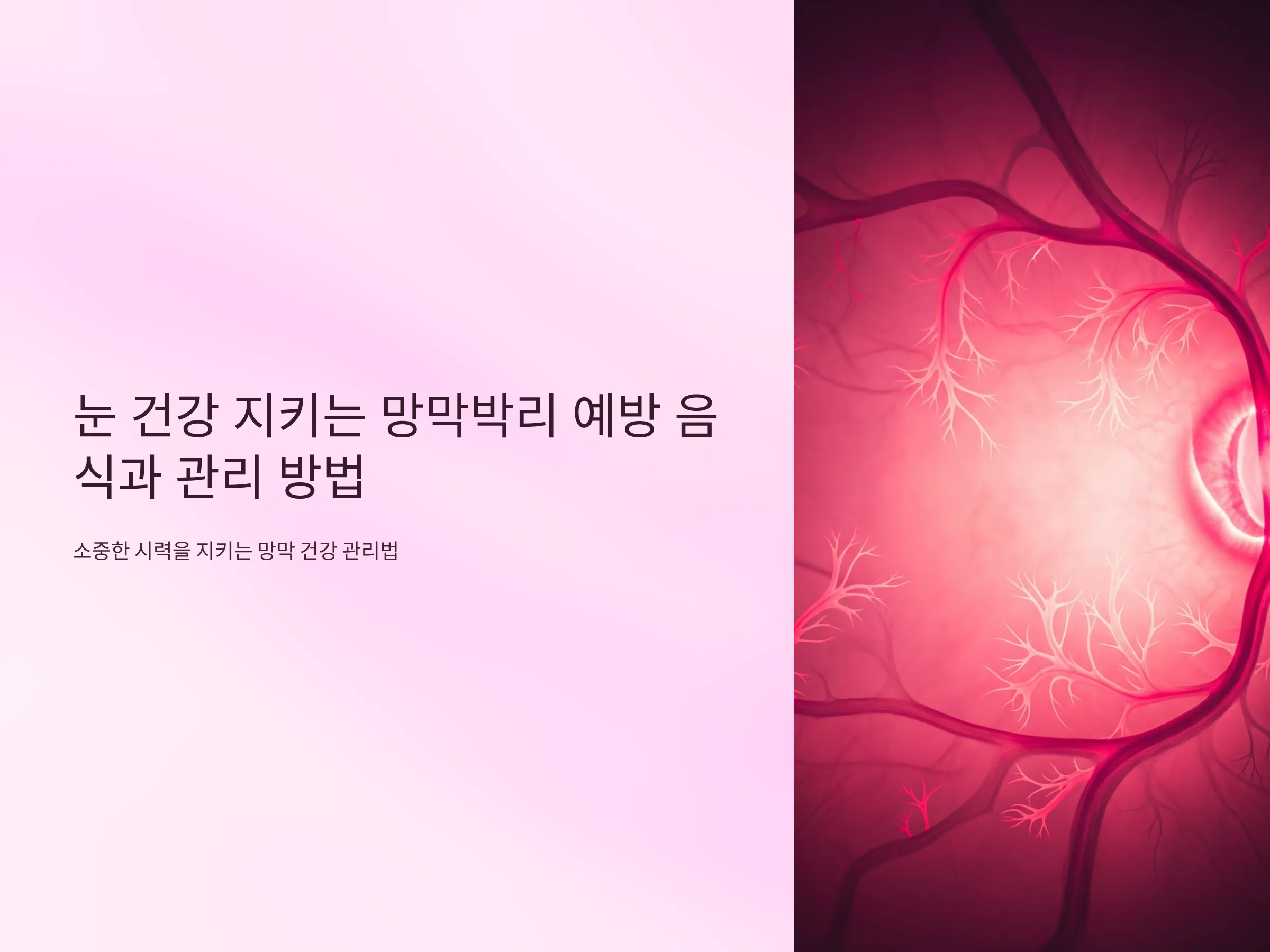 망막박리와 눈 건강의 기초 이해