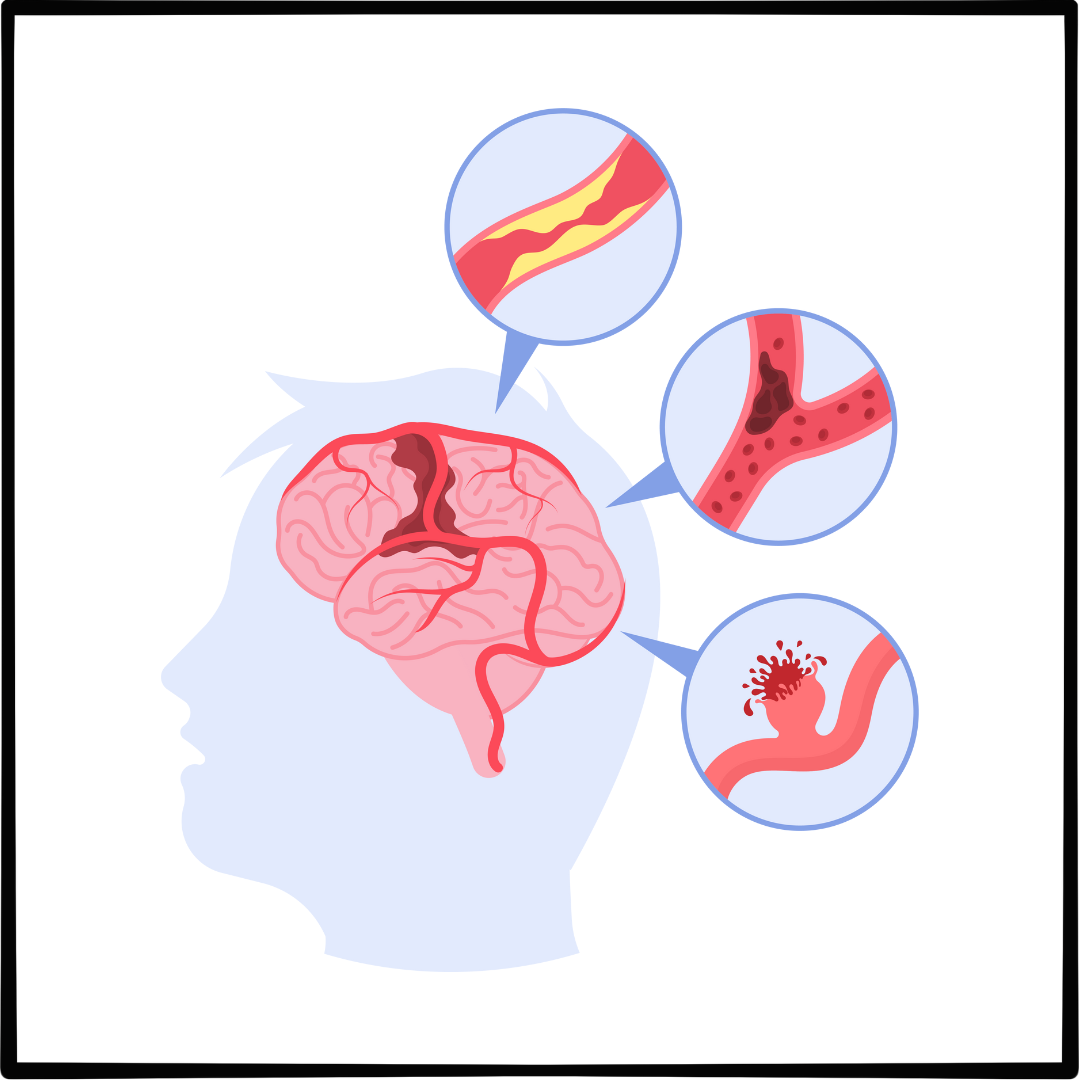피로감: 만성 피로의 원인과 증상 해결방법