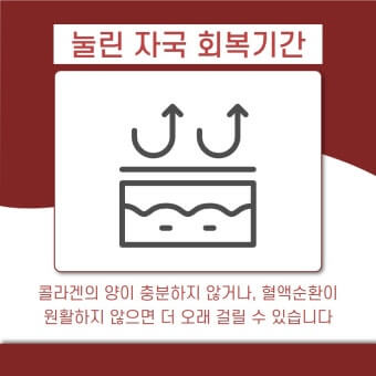 눌린 자국 회복 시간